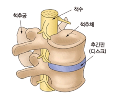 허리디스크