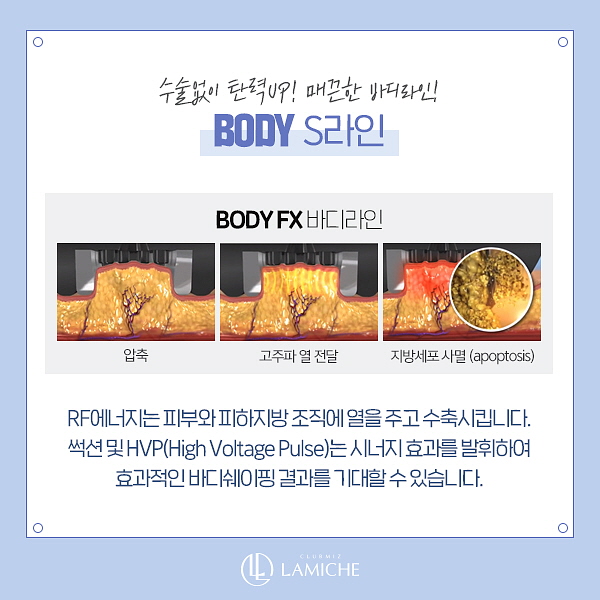 미간주름제거 5