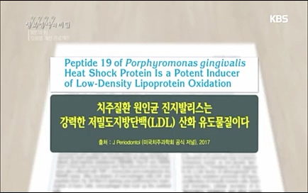 [670회] 생로병사의 비밀 - KBS670회] 생로병사의 비밀.ts_20220505_142428.104.jpg