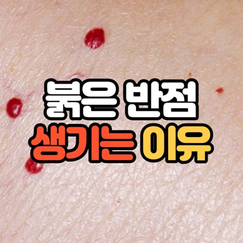 피부에 붉은반점 원인