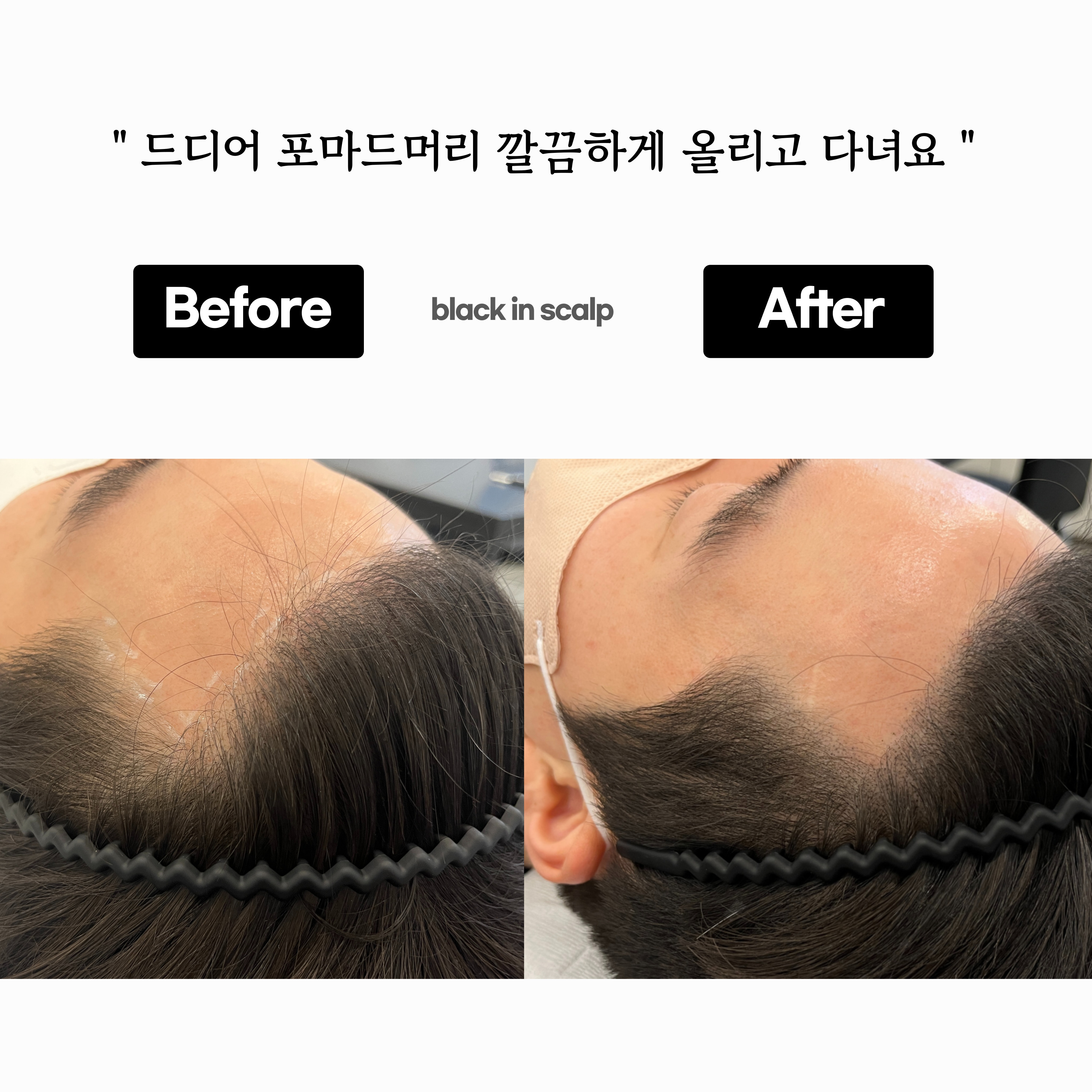 블랙인스칼프 이미지