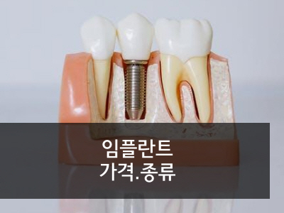 임플란트 종류