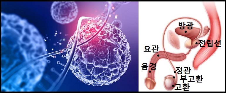  전립선암.전립선병기.전립선증상.전립선검사.전립선수술.전립선 발생원인. 전립선 예방.전립선은 왜생기는가?