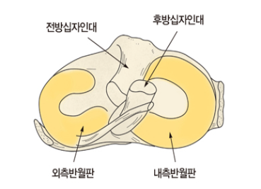  반월상 연골 파열 증상/원인/비 수술 치료