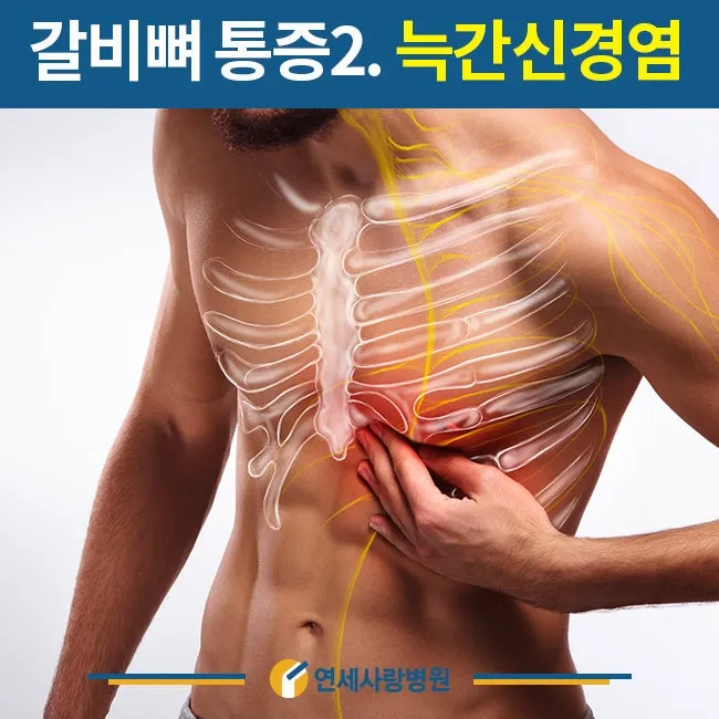 왼쪽 갈비뼈 통증 원인 대처방법 총정리_1