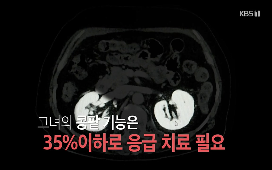 생로병사의 비밀.E819.220421p-NEXT.mp4_20220421_190926.735.jpg