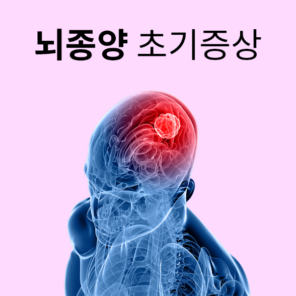  뇌종양 초기증상 반드시 확인하세요