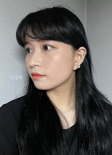 Facial Contouring, Rhinoplasty before2