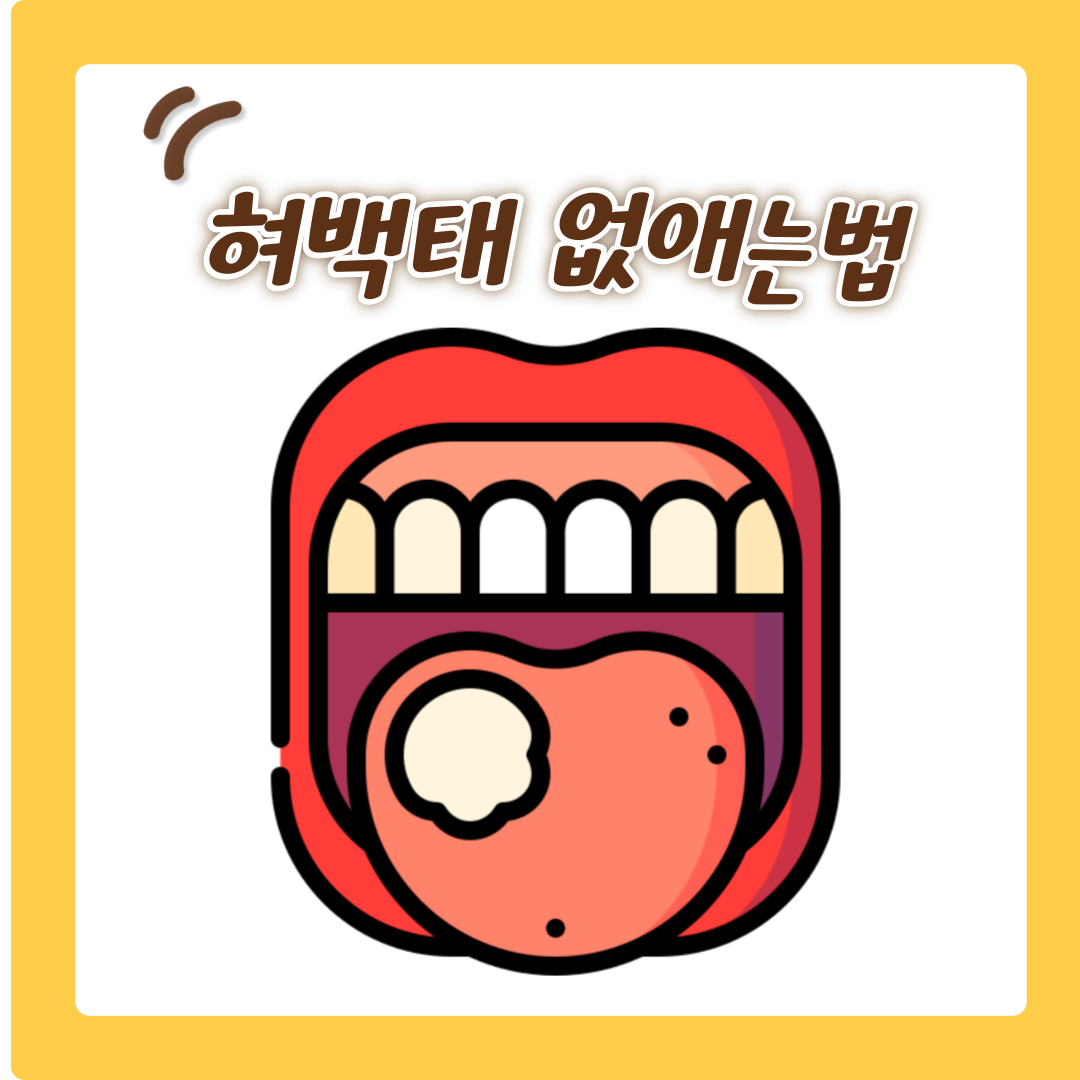  혀백태 없애는법 2가지와 혀백태 원인 알아보기