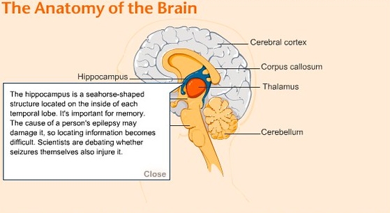 뇌전증: 원인과 이해1