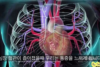  혈관 검사 받아야 한다고 하던데.., 혈관의 모든 것을 알아보자.