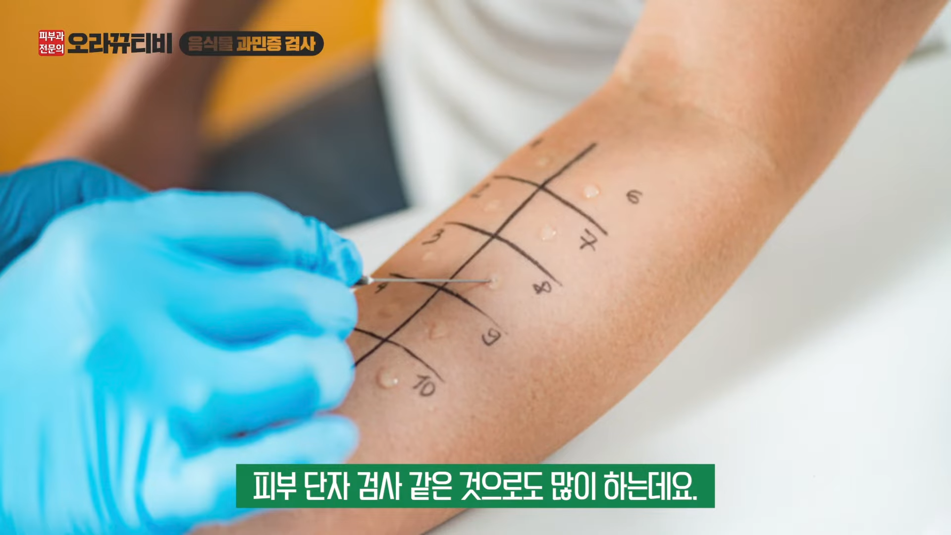 음식물 과민증 검사 병원