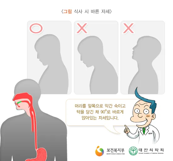 연하곤란 뜻 원인 증상 치료법_7