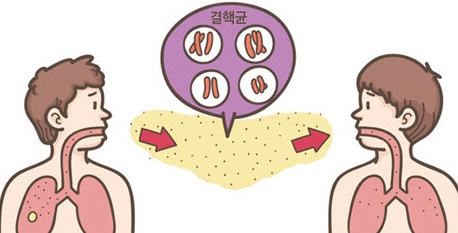  결핵 전염 유무 및 초기 증상 결핵 예방접종 시기와 원인 입니다.