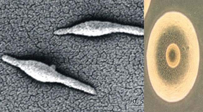 마이코플라즈마 폐렴균 현미경사진