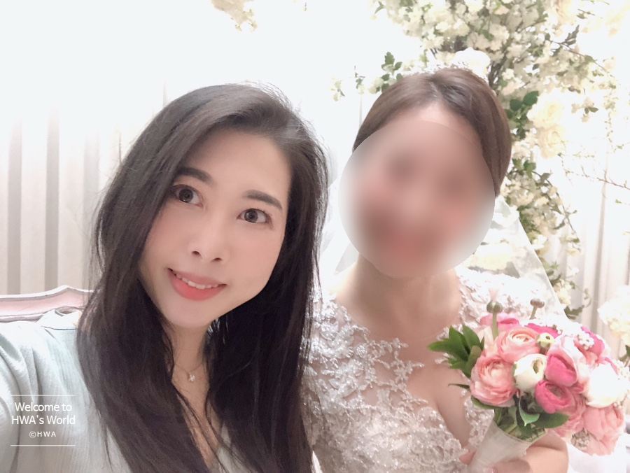 콧볼 축소 비용 [강남/보톡스] 콧볼축소주사-후기 3