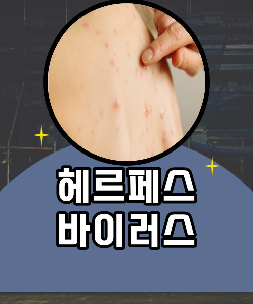  성병으로 오해하는 헤르페스 바이러스 포도송이처럼 입술에도 감염될수있어요