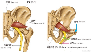 골반뼈-신경-근육-이미지