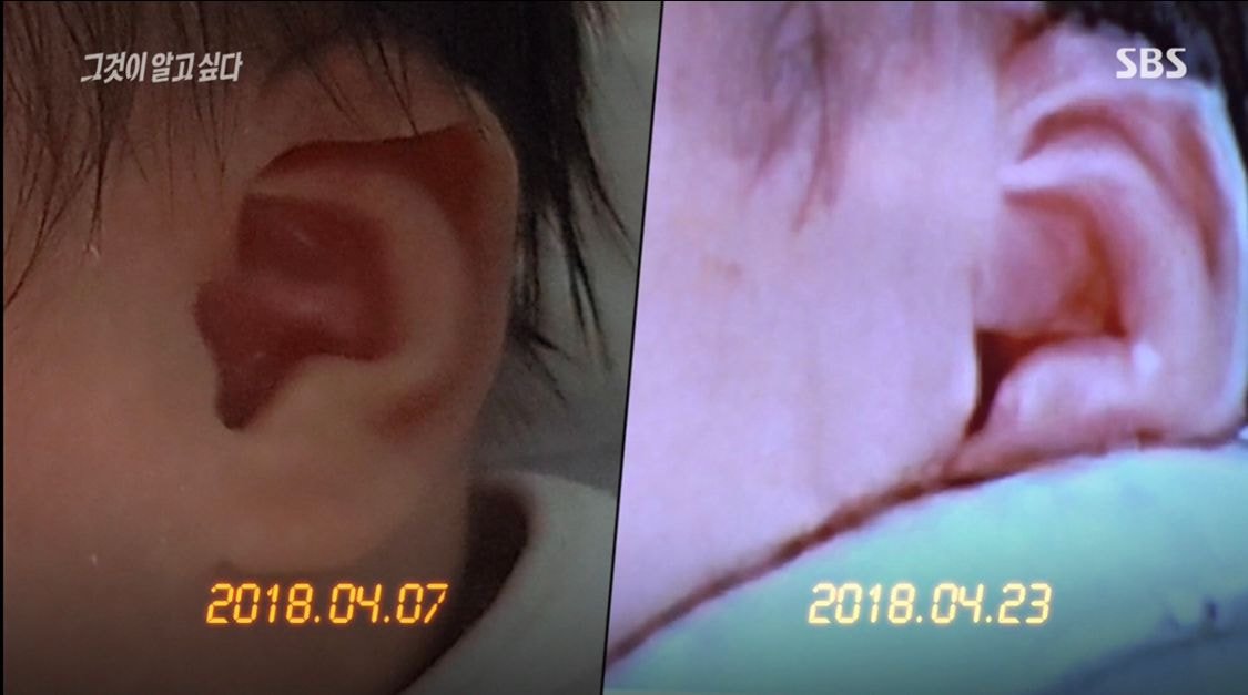  오늘 구미여아사망사건 그알 요약