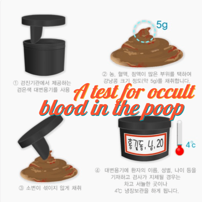 A test for occult blood in the poop