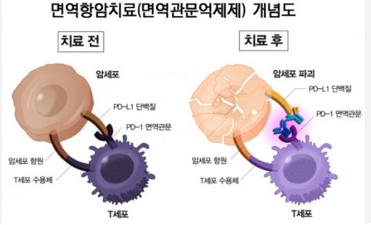 암 치료의 희망