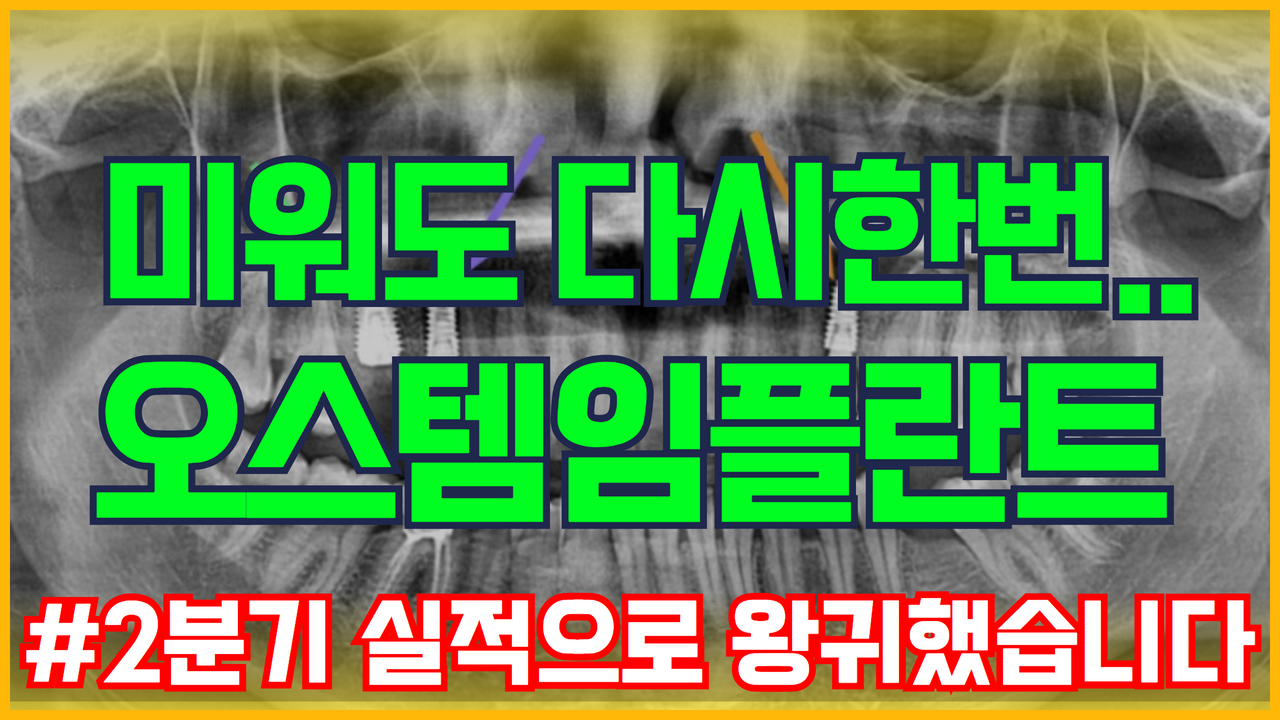  미워도 다시한번 .. 오스템임플란트 주가 전망 | 실적 왕의 귀환