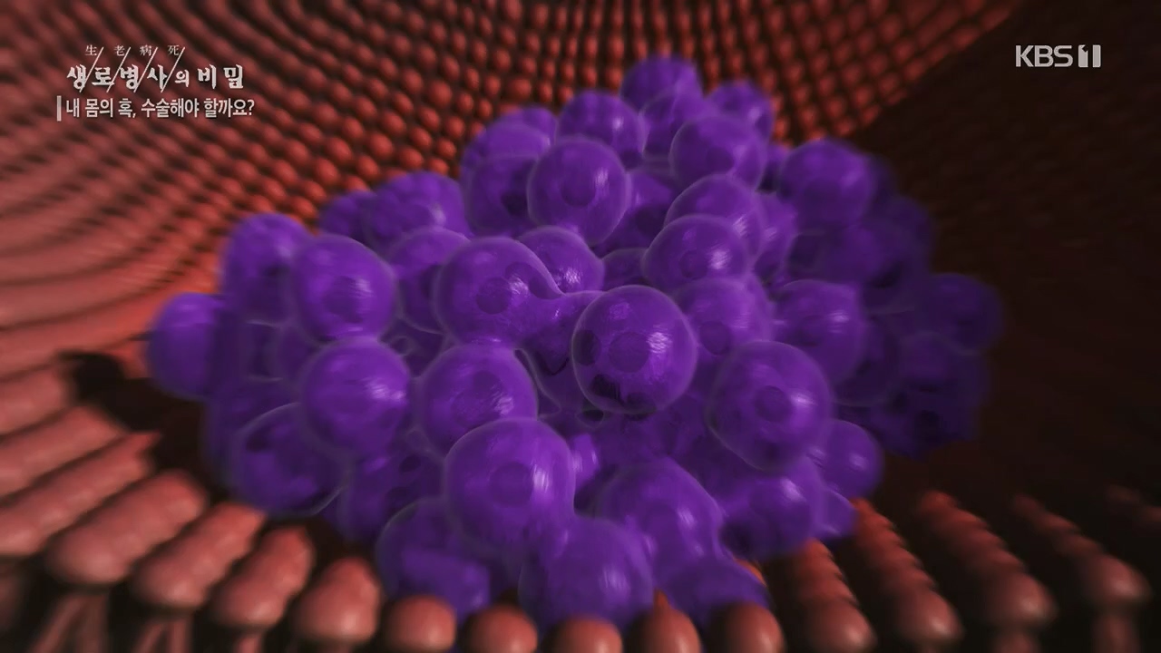 생로병사의 비밀.E870.230532p.H264-F1RST.mp4_20230605_201518.442.jpg