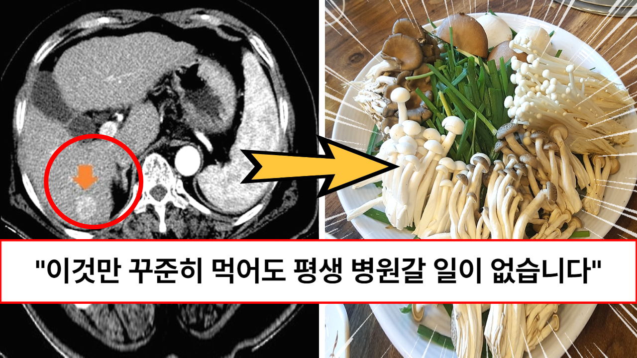 “암세포도 씨가 말라 죽습니다” 다른 영양제 안 먹어도 이것만 먹으면 평생 병원갈 일이 없다는 조합