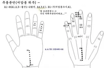 두통 수지침 편두통 혈자리_19