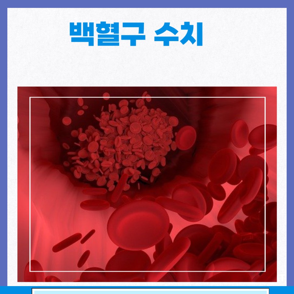 백혈구 수치 낮으면 :백혈구 정상수치 백혈구 감소증