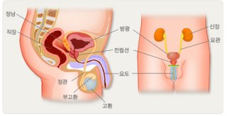 전립선암 증상