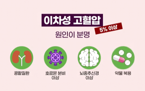 1 차성 고혈압과 2 차성 고혈압 