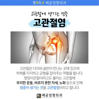 고관절 통증 증상 확인하기_12