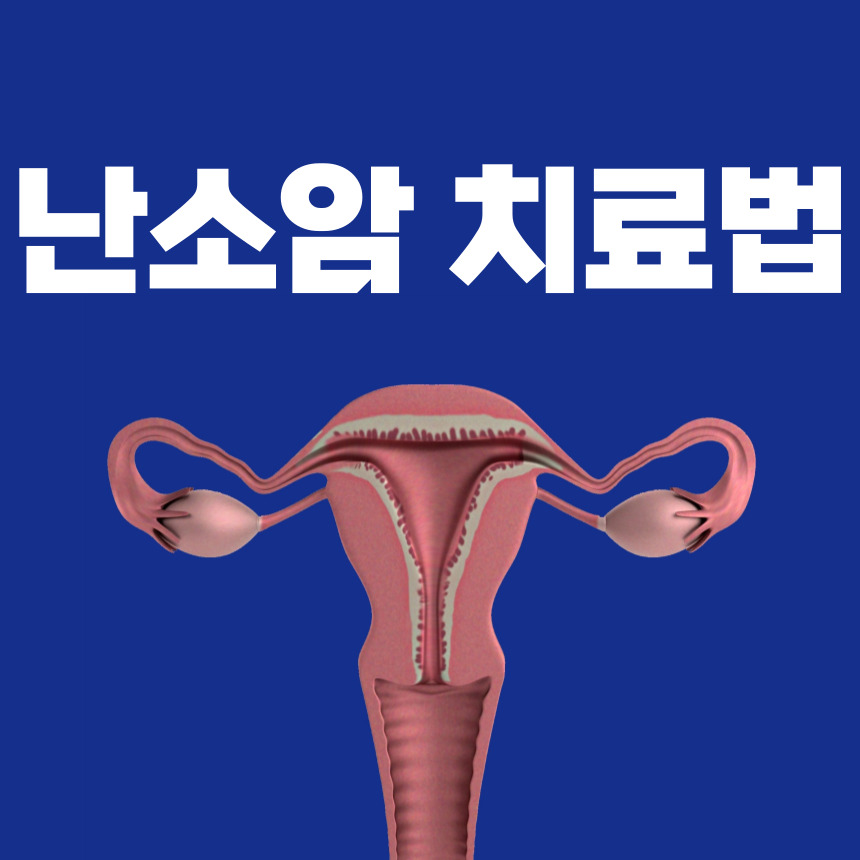 난소암 치료법