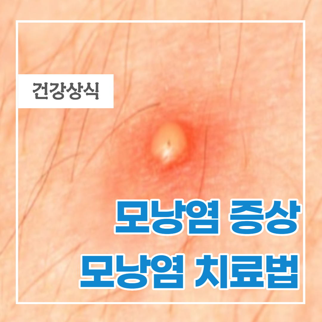 모낭염 증상과 치료방법