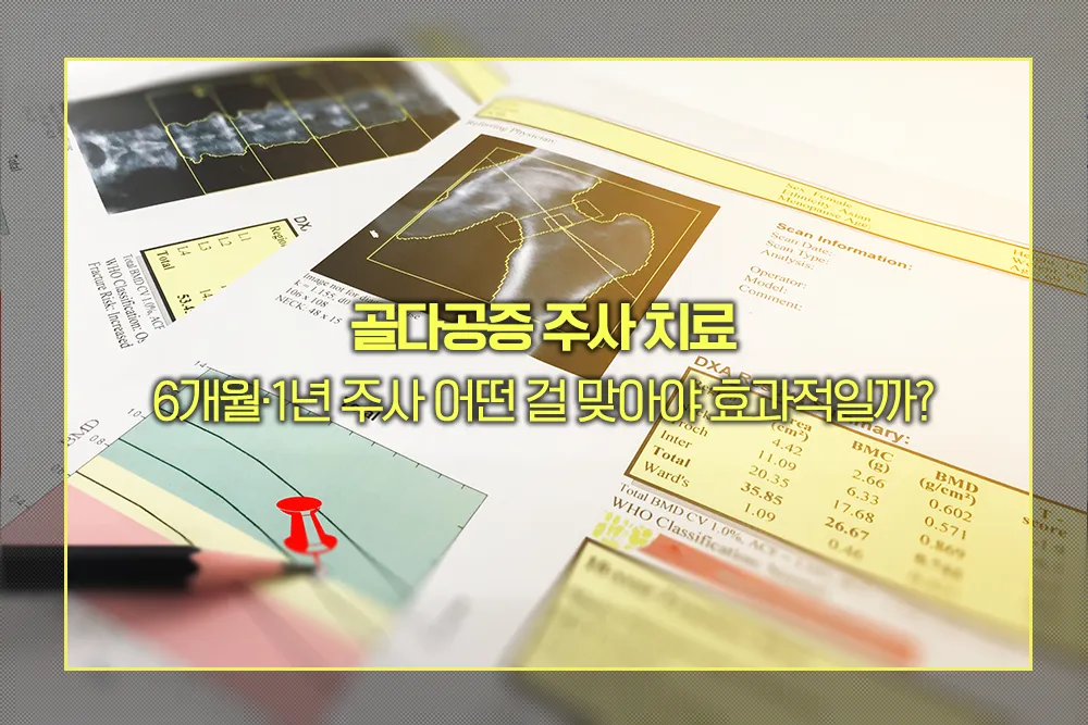 골다공증 주사 치료 효과