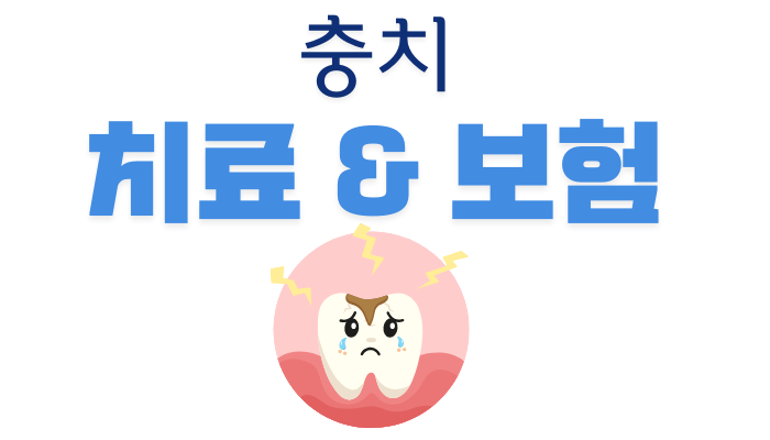충치 치료 방법 비용 및 보험 추천