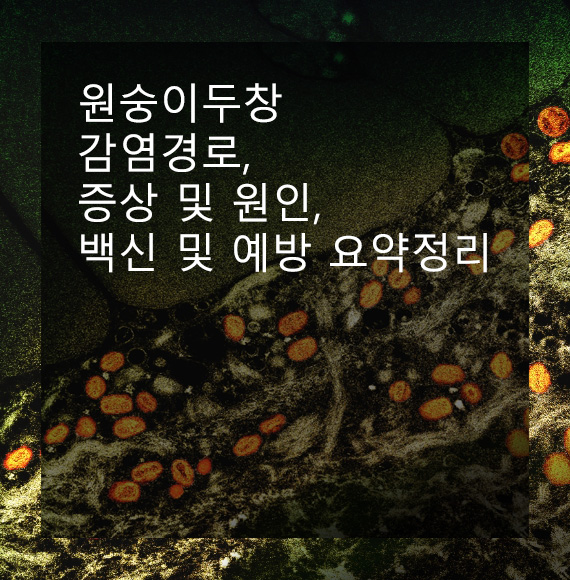 원숭이두창 감염경로, 증상 및 원인, 백신