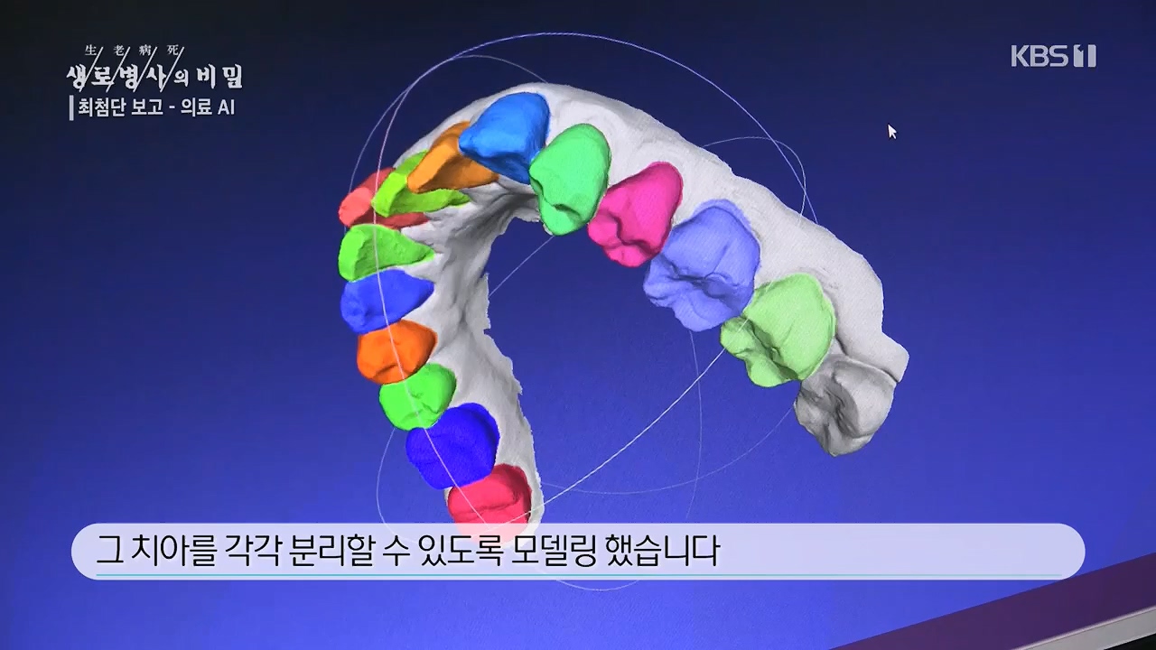 생로병사의 비밀.E869.230518p.H264-F1RST.mp4_20230518_200710.588.jpg