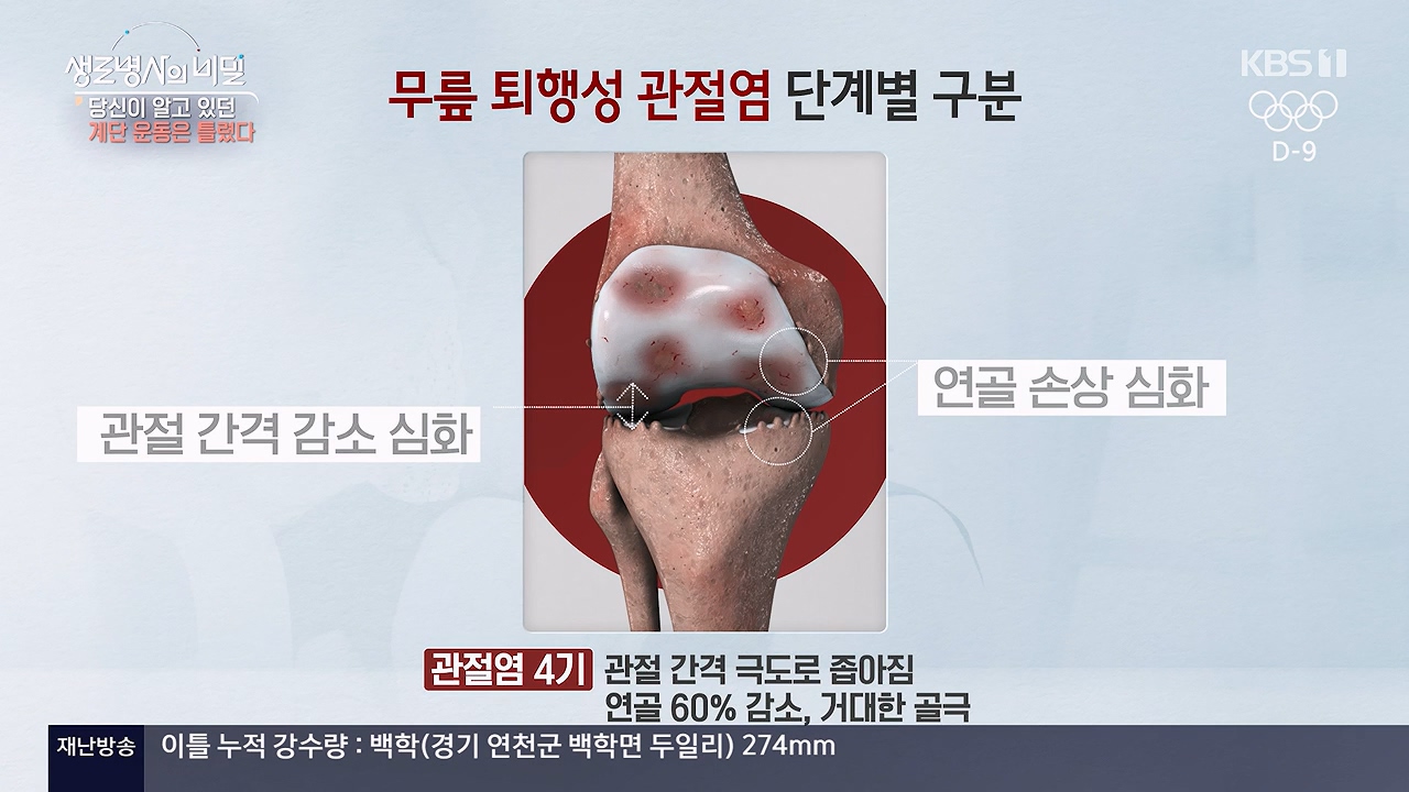 생로병사의 비밀.E920.240718p-NEXT.mp4_20240718_201553.107.jpg