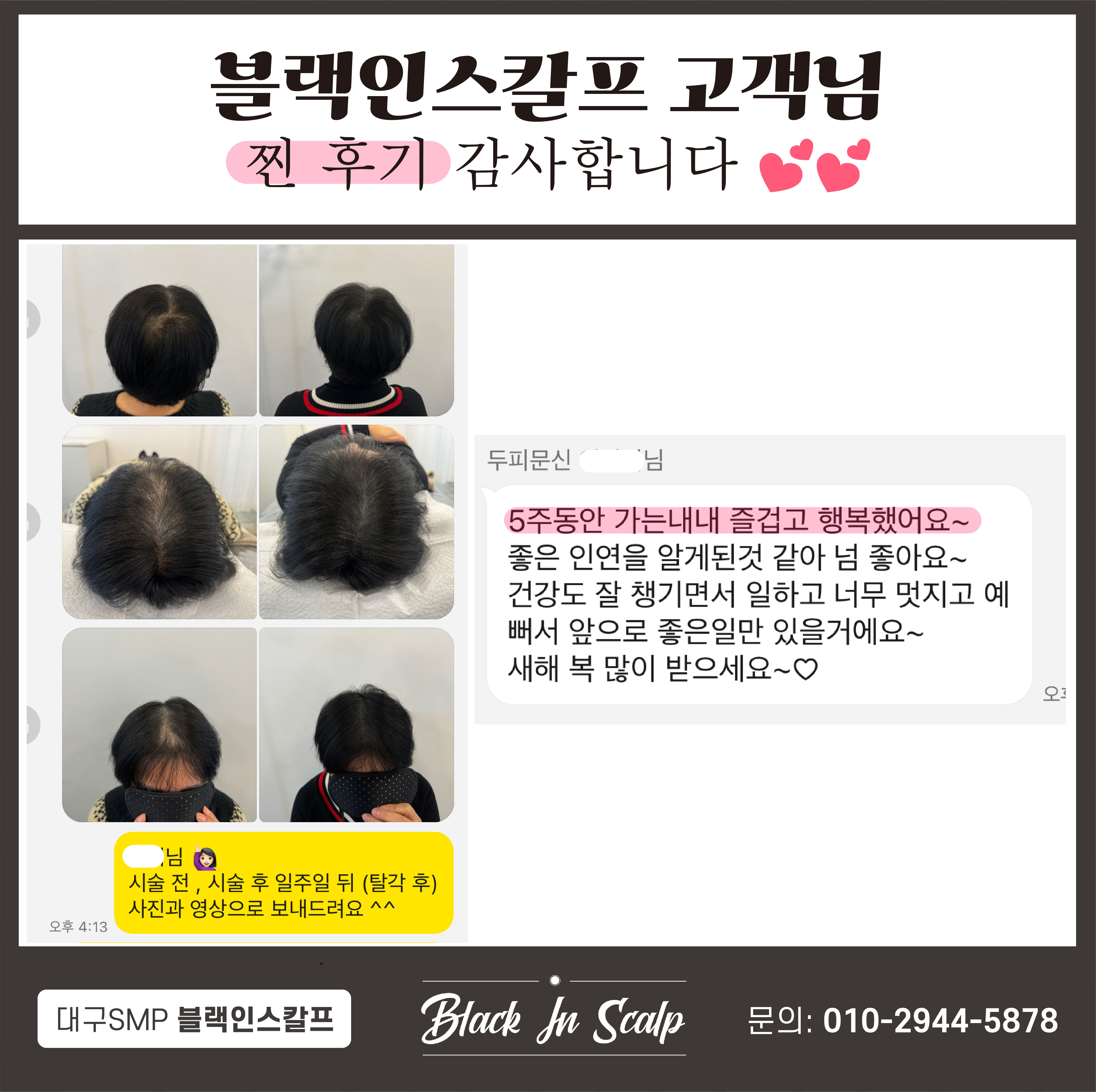 블랙인스칼프 이미지