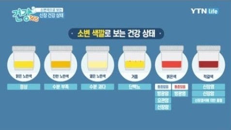 소변 색깔로 확인하는 건강 상태