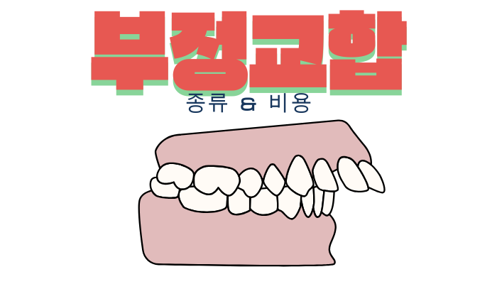 부정 교합 교정 비용 총정리