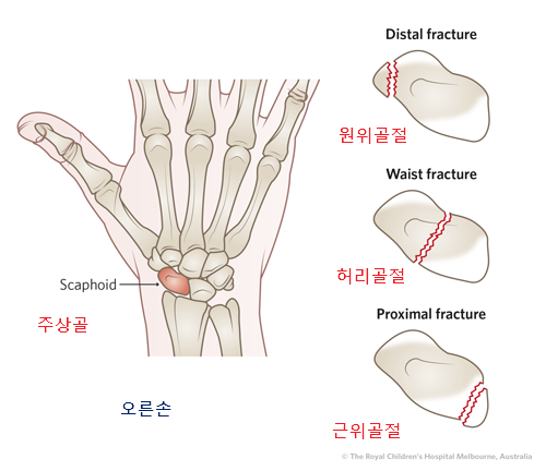 주상골의 해부학적 구조 사진