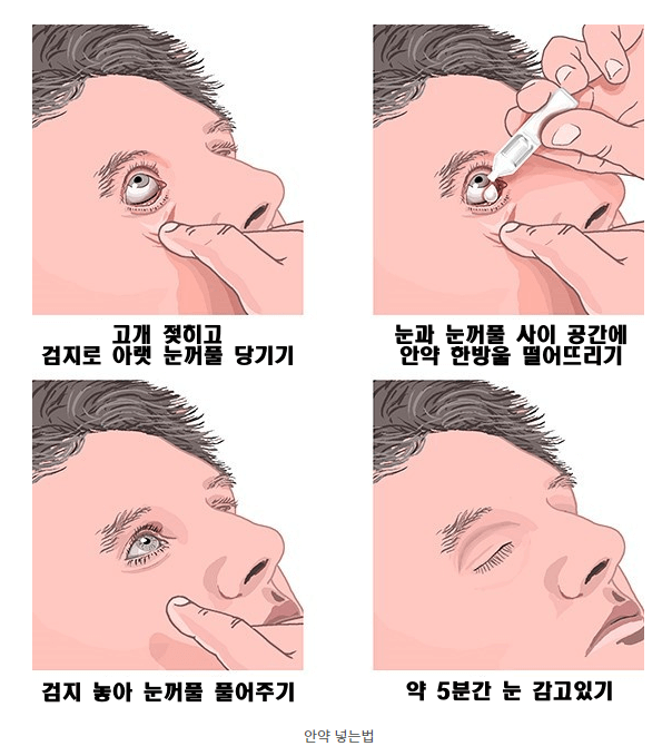 안약넣는법