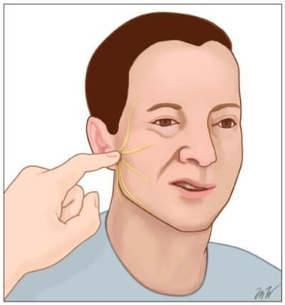 일반적으로 치료에 관해서는 가능한 한 빨리
