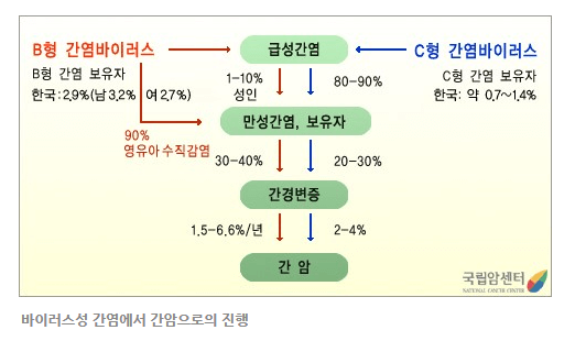 간암의 이해:원인&#44;증상&#44; 진행단계&#44; 진단&#44; 생존율&#44; 검사&#44; 치료법