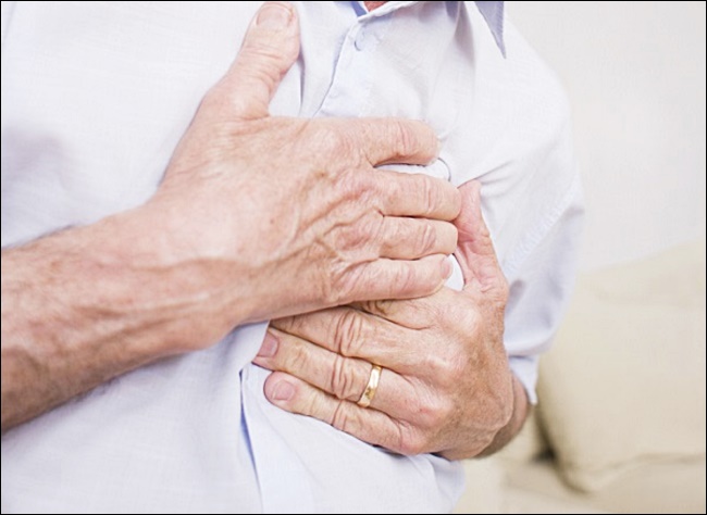 협심증 초기 증상 3