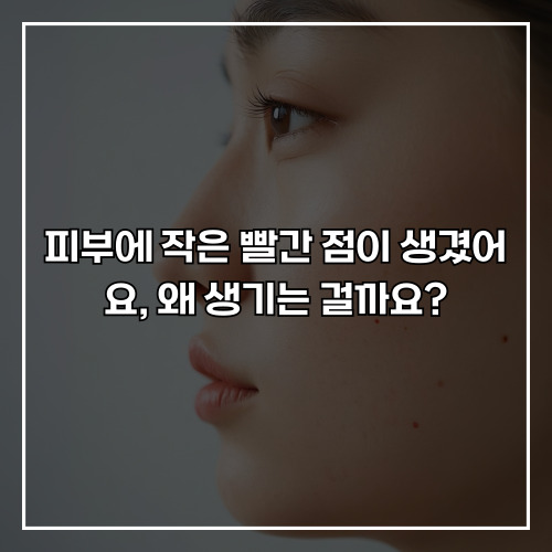 피부에 작은 빨간 점이 생겼어요, 왜 생기는 걸까요?