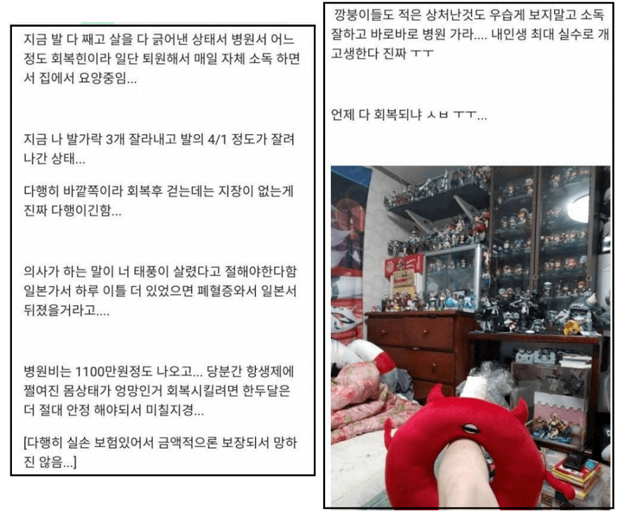 손톱깎이로 티눈 제거하려다 발가락 자른 사례